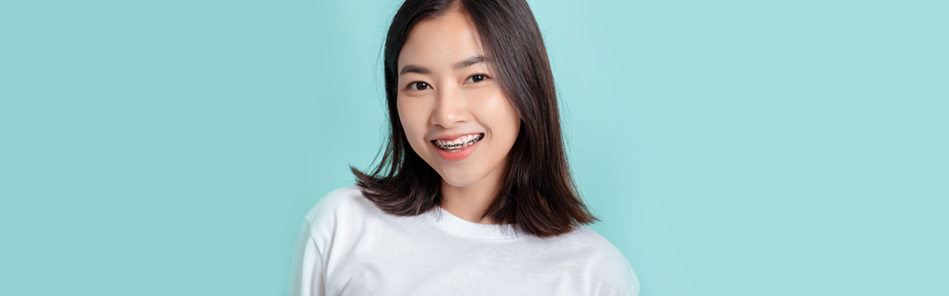 Things You Should Know about Dental Braces